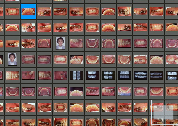 「納得した歯科治療」の為の記録・写真
